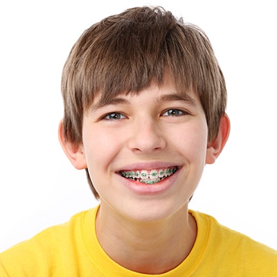 Young boy with braces Lakewood Orthodontics in Lee's Summit MO and Mission, KS