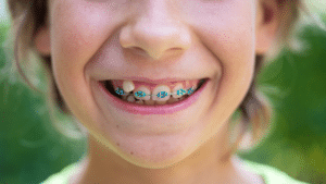 Orthodontist in Independence