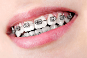 Orthodontist in Roeland Park