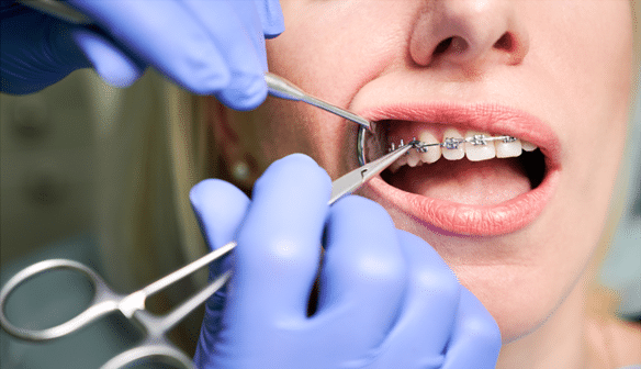 Orthodontist in Independence