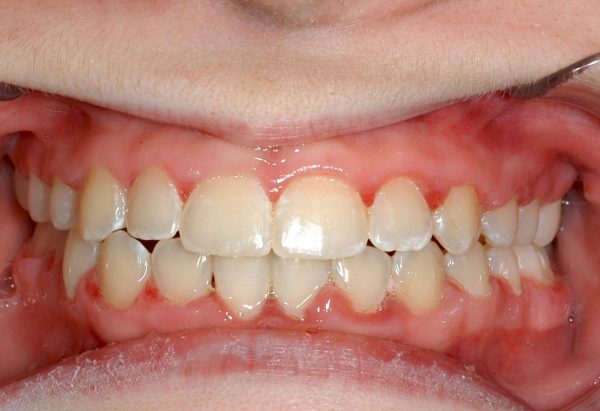 lakewood orthodontics