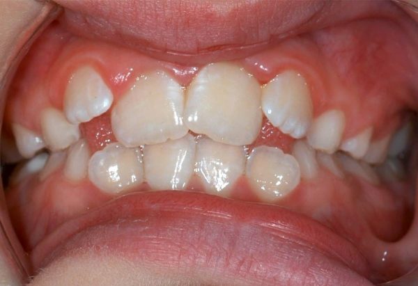 lakewood orthodontics