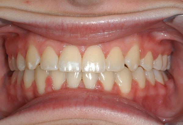 lakewood orthodontics