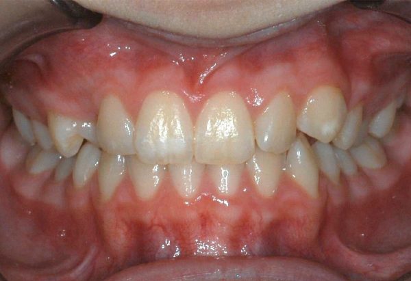 lakewood orthodontics