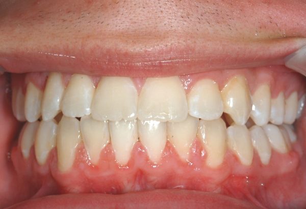 lakewood orthodontics