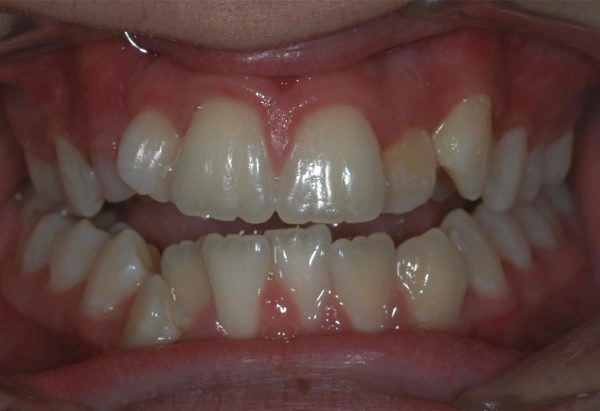 lakewood orthodontics
