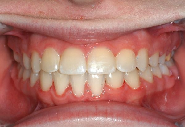 lakewood orthodontics