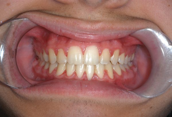 lakewood orthodontics