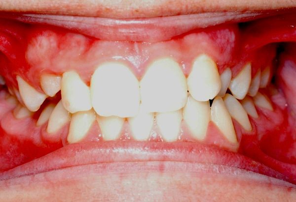 lakewood orthodontics