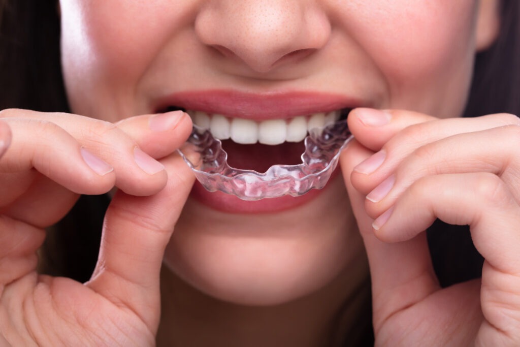 Retainers in Independence