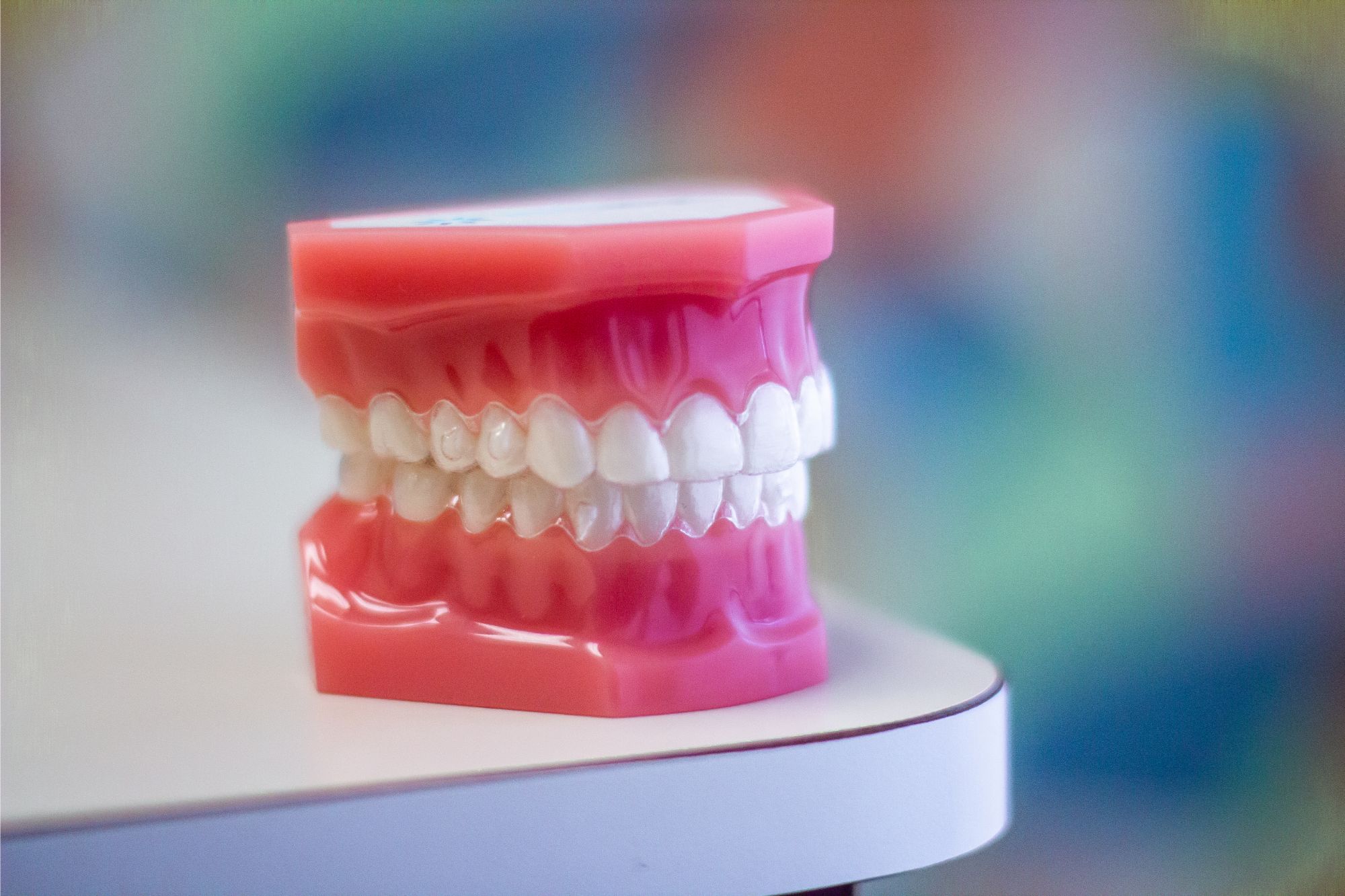 Clear aligner on a dental model of teeth at Lakewood Orthodontics in Lee's Summit, MO