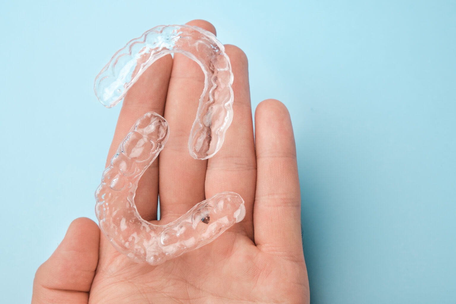 Hand holding a clear aligner tray for orthodontic treatment
